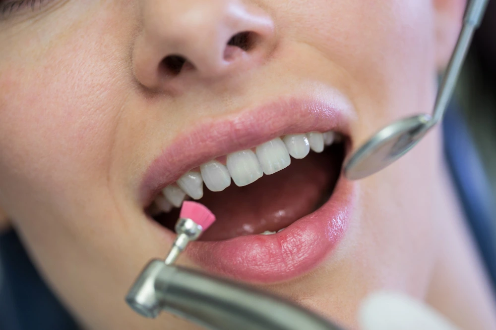 cosmetic dentistry in lee's summit